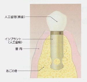 imp-q01.gif