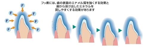 フッ素.jpeg